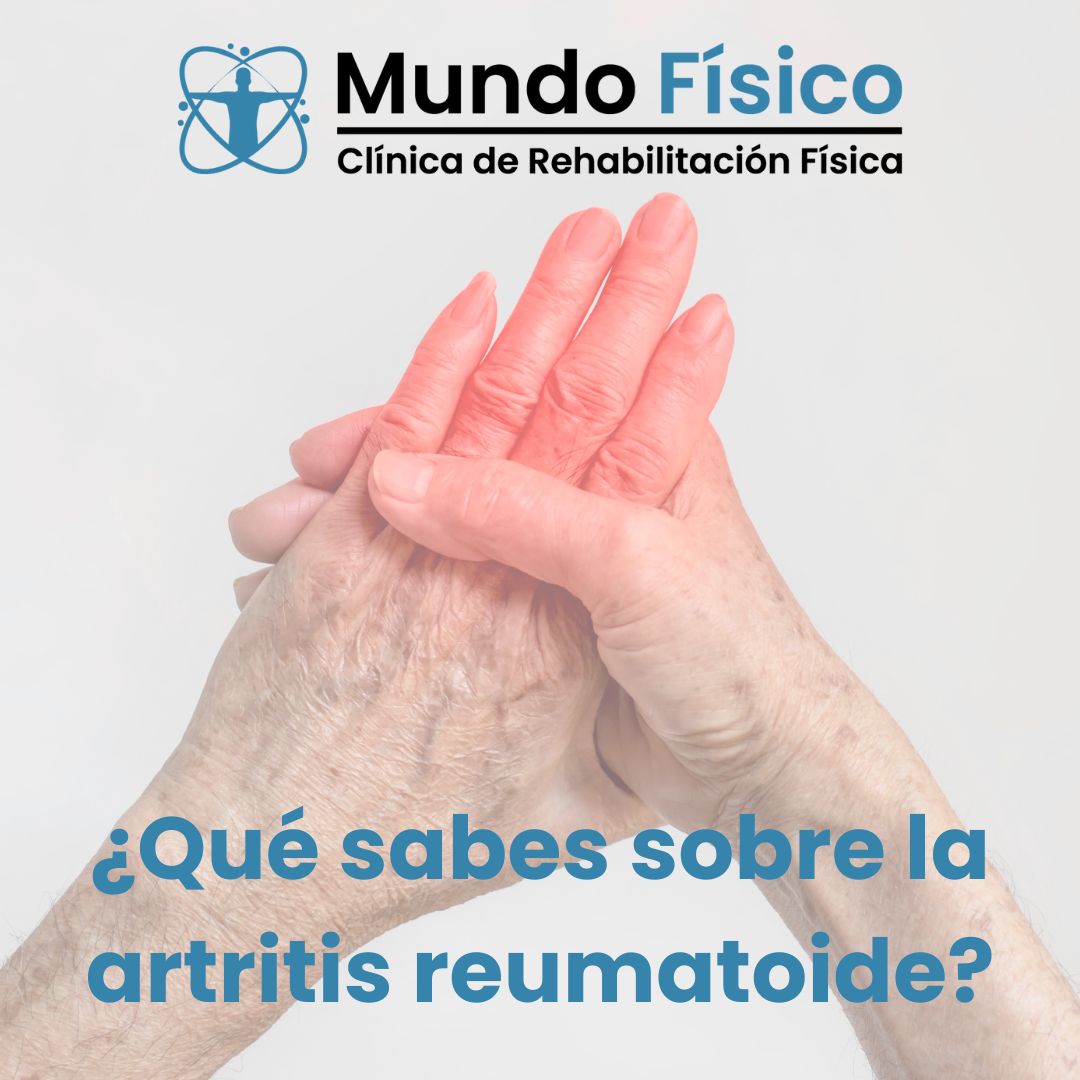 Que sabes sobre la artritis reumatoide